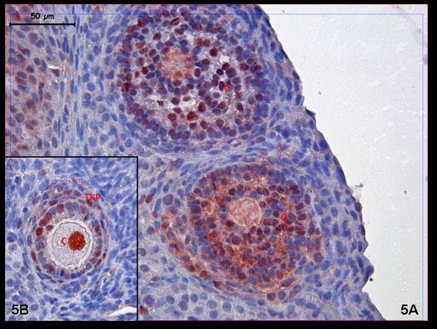 Resim 5A,B: Hormon uygulaması yapılan gruplara ait ovaryum dokusunda PCNA immünreaktivitesinin özellikle çekirdek düzeyinde ve granüloza hücrelerinde yaygın