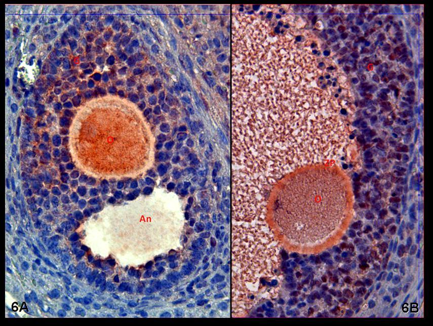 Resim 6A,B: Hormon uygulaması yapılan gruplara ait ovaryum dokusunda yaygın PCNA immünreaktivitesi görülüyor.