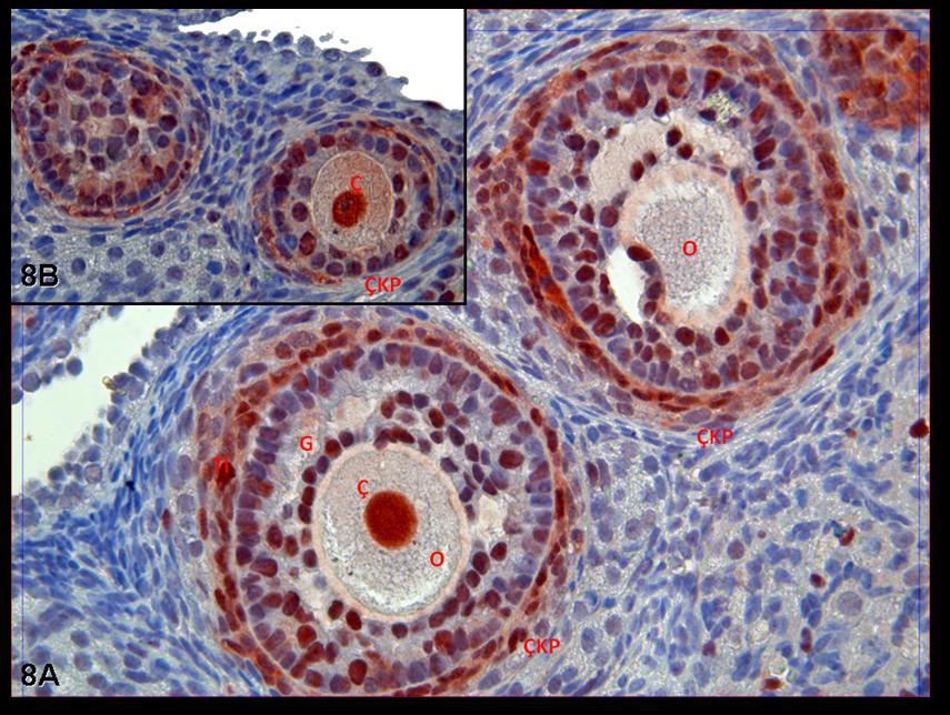 Resim 8A,B: Hormon uygulaması yapılan gruba ait gebe ovaryumlarında PCNA immünreaktivitesinin çekirdek düzeyinde son derece belirgin olduğu görülüyor.