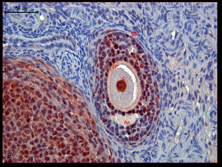Resim 9: Hormon uygulaması yapılan gruba ait gebe ovaryumlarında PCNA boyamasında; oosit çekirdeğinde ve granuloza hücrelerinde belirgin tutulum izleniyor.