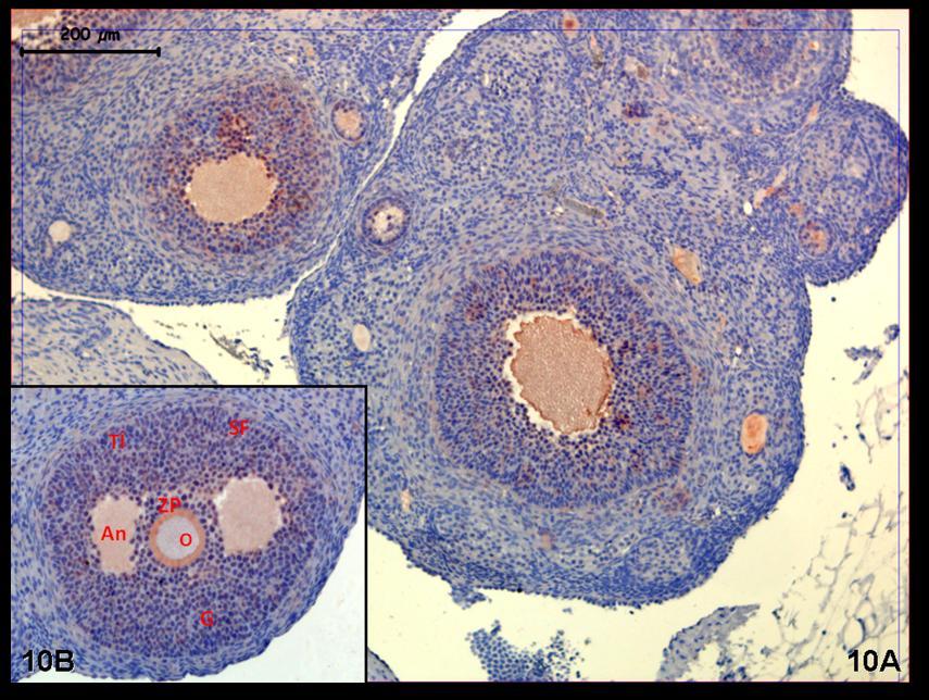 Resim 10A,B: Klomifen sitrat uygulaması yapılan gruba ait kontrol grubu ovaryum dokusunda PCNA tutulumunun doku genelinde hormon kontrol grubuna eşdeş olduğu görülüyor.