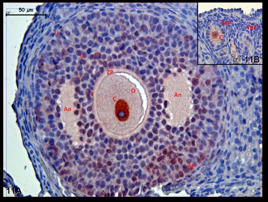 Resim 11A,B: Klomifen sitrat uygulaması yapılan gruba ait kontrol grubu ovaryum dokusunda yapılan PCNA boyamasında; çekirdek tutulumunun sekonder folikülde primer foliküllere karşın kuvvetli olduğu