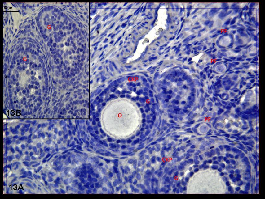 Resim 13A,B: Klomifen sitrat uygulaması yapılan gruba ait ovaryum dokularında büyük büyültmeli resimlerde, granüloza hücrelerinde ve çekirdek düzeyinde PCNA tutulumunun az olduğu görülürken,