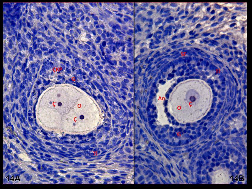 Resim 14A,B: Klomifen sitrat uygulaması yapılan gruba ait ovaryum dokularında PCNA boyamasında; çok sıralı primer folliküllerde birden fazla oositin varlığı dikkati çekiyor.