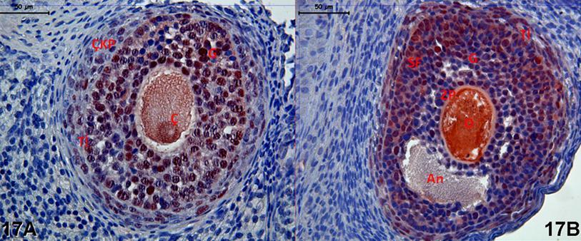 Resim 17A,B: Klomifen sitrat uygulaması yapılan gruba ait gebe ovaryumlarında PCNA boyamasında tutulumun oosit, granuloza ve teka interna hücrelerinde belirgin olduğu görülüyor.
