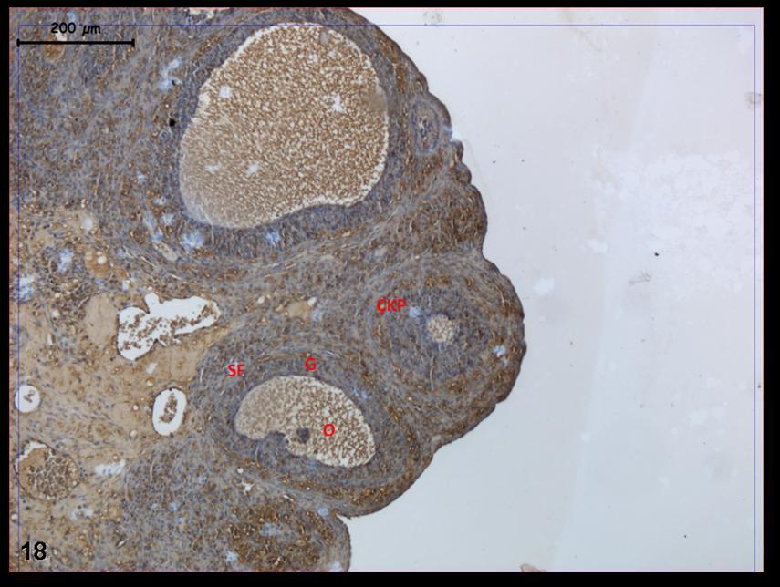 Resim 18: Hormon uygulaması yapılan gruba ait kontrol grubu ovaryumlarında c-fos tutulumunun, tüm folliküllerde oosit sitoplazması, granüloza hücreleri ve teka interna