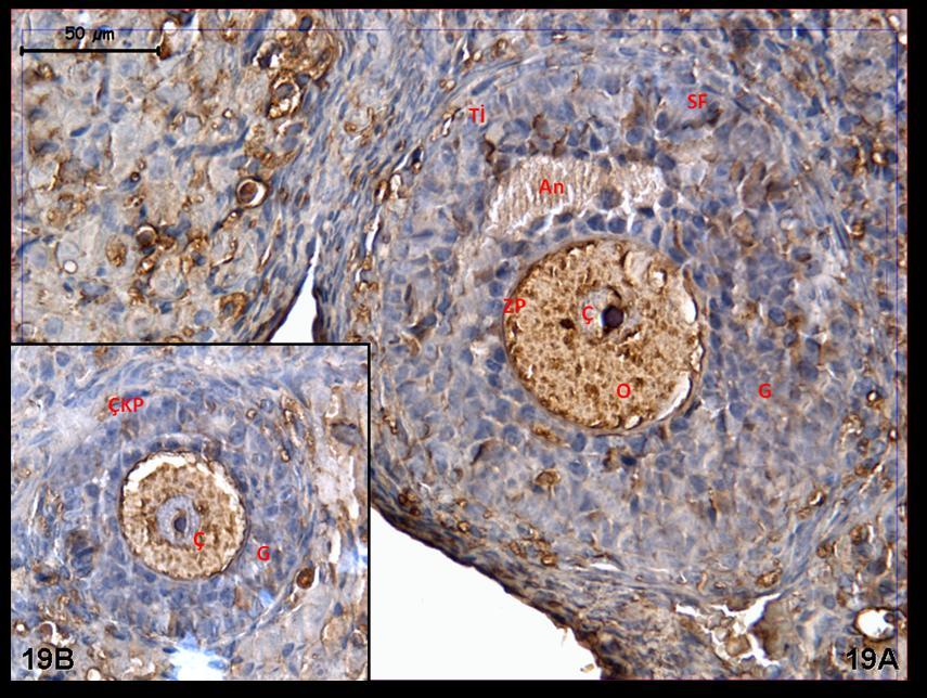 Resim 19A,B: Hormon uygulaması yapılan gruba ait kontrol grubu ovaryumlarında c-fos immünreaktivitesinin çekirdek ve sitoplazma düzeyinde, granüler şekilde ve çoğunlukla orta dereceli olduğu ilgiyi