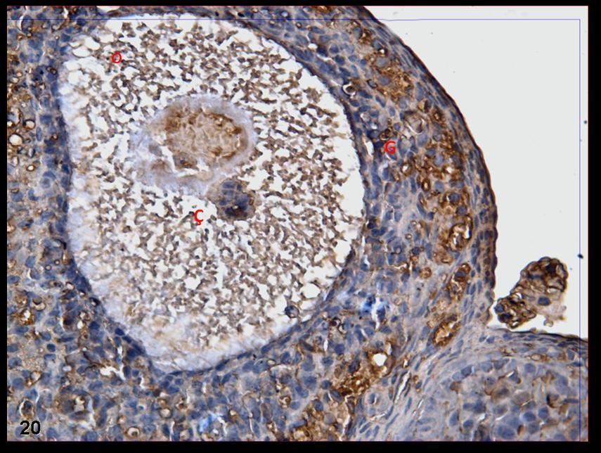 Resim 20: Hormon uygulaması yapılan gruba ait kontrol grubu ovaryumlarında c-fos boyamasında daha büyük büyültmelerde de tutulumun