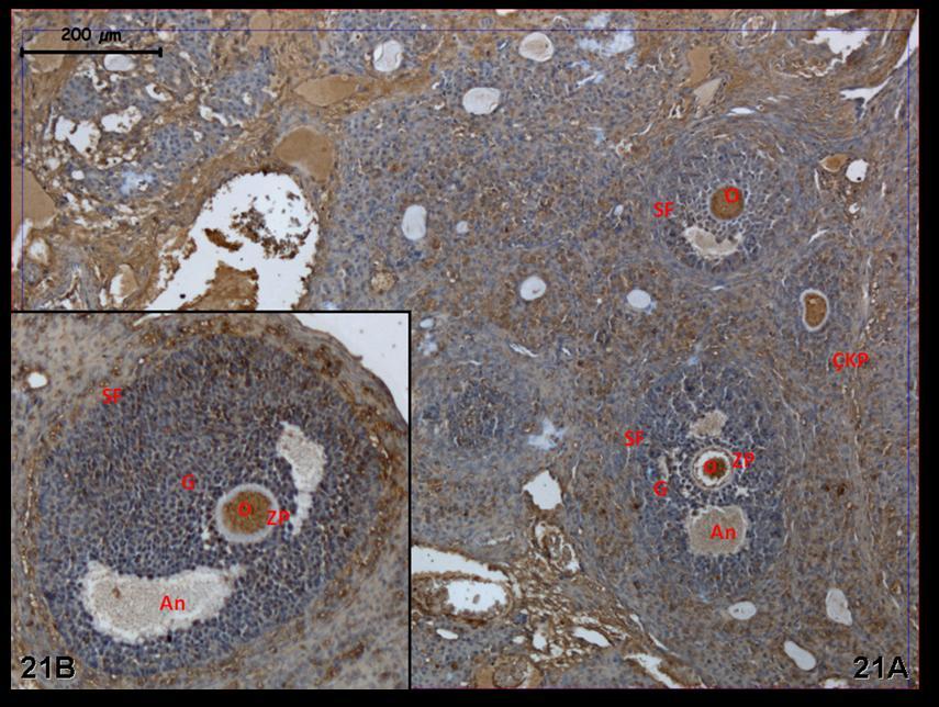 Resim 21A,B: Hormon uygulaması yapılan gruba ait ovaryum dokusunda c-fos boyamasında tutulumun bir önceki gruba karşın doku genelinde biraz daha arttığı görülüyor.
