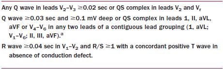 Önceki MI ile İlişkili EKG Değişiklikleri Third Universal Definition of Myocardial