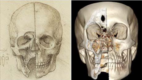1489 tarihli bir defterde bir çok kafatası çizimi bulunuyor. Leonardo bu çizimleri yapabilmek için kadavraların yüzlerini kesmiş. Yüz kemiklerini anatomik yapılarına zarar vermeden kesmek oldukça zor.