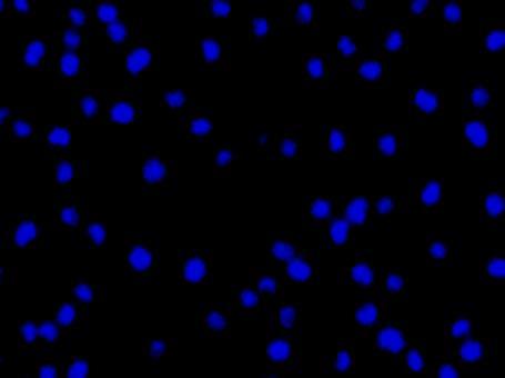 20 a- normal hücre b- erken apoptotik c- geç