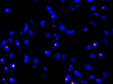 HO/PI Boyama: normal hücre (a), erken apoptotik