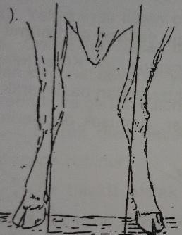 Şekil 8. Önleri açık veya geniş bacak duruşu Şekil 9. Öküz dizli bacak duruşu 2.