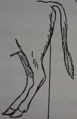 2.2.2.2 Bozuk bacakları duruşları 2.2.2.2.1.Ardları ileri bacak duruşu: Bacak, düşey çizginin ön tarafında ve ileride bulunur.