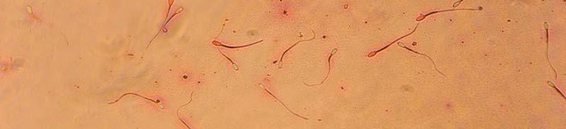 36 Resim 2.4. Ölü ve canlı spermatozoonlar (eozin boyama-sürme preparat). Canlı spermatozoonlar eozin boyayı almamakta ve baş kısmı açık renkte görülmektedir (oklar).