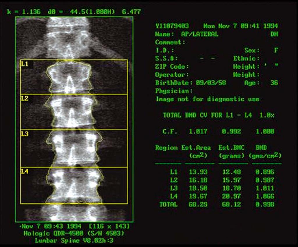 Lumbar spine