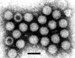 Rotaviruslar Reoviridae ailesinden,çift kapsitli Nükleik asiti 11 parçalı çift zincirli RNA Beş yaşa kadar çocuklarda ciddi gastroenterit salgınları yapar.