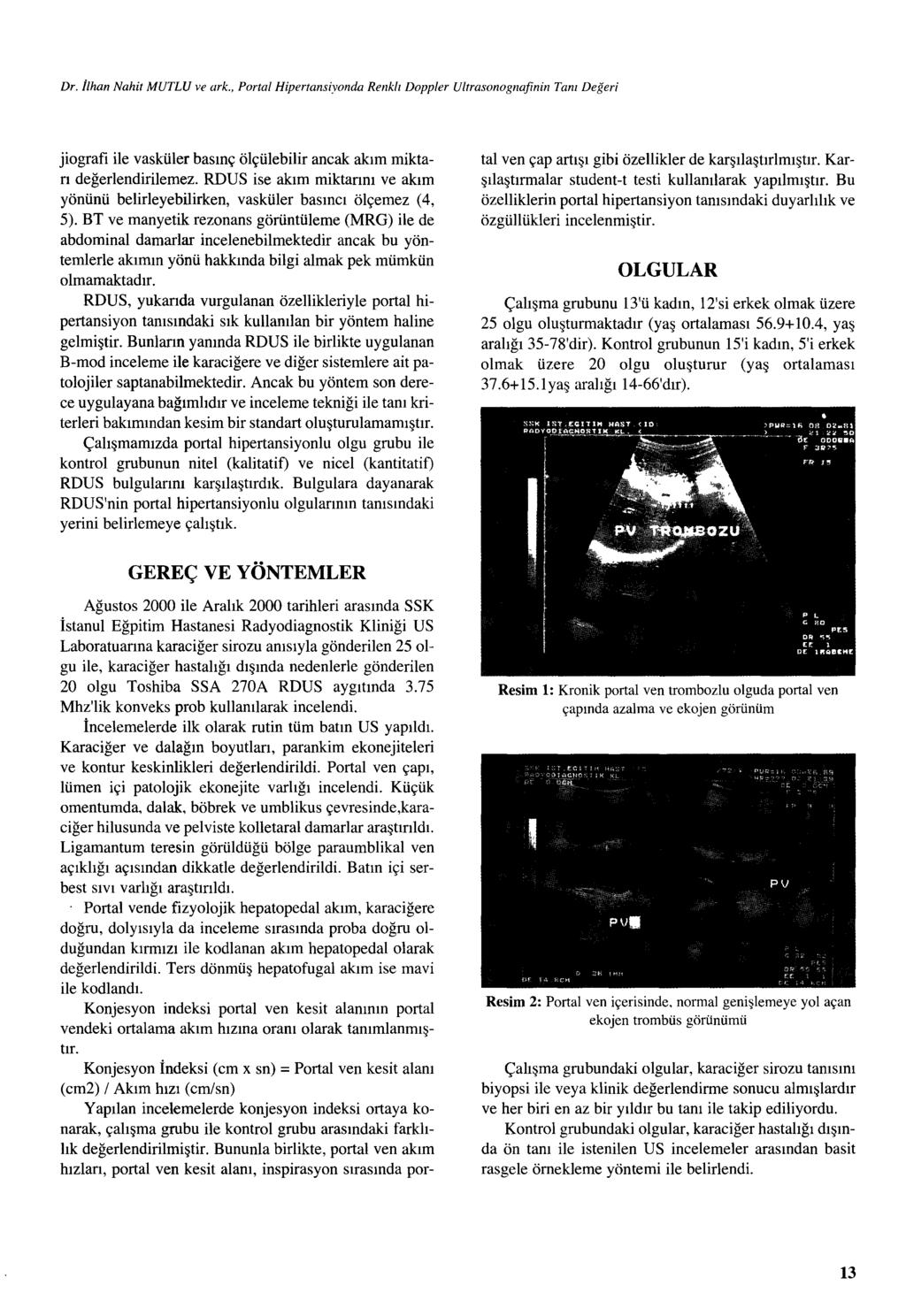 Dr. İlhan Nahit MUTLU ve ark., Porta/ Hipertansiyonda Renk/ı Doppler Ultrasonognafinin Tam Değeri jiografi ile vasküler basınç ölçülebilir ancak akım miktarı değerlendirilemez.