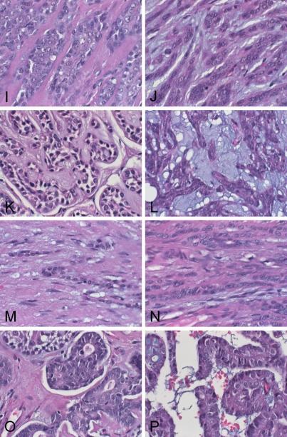 Morphological heterogeneity of oral salivary gland carcinomas: a clinicopathologic study of 41 cases with long term follow-up emphasizing