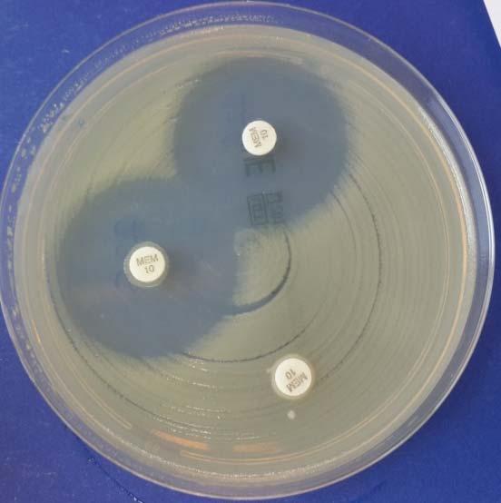 CIM Testi Carbapenem inactivation method CIM Testi Basit Ucuz Yavaş (1 gün) 1 2 Şekil.