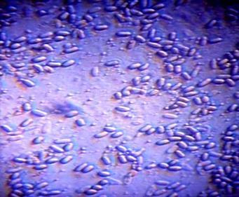 Protozoan Hastalıklar Etmeni