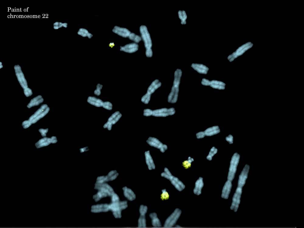 This image shows a paint of chromosome 22.