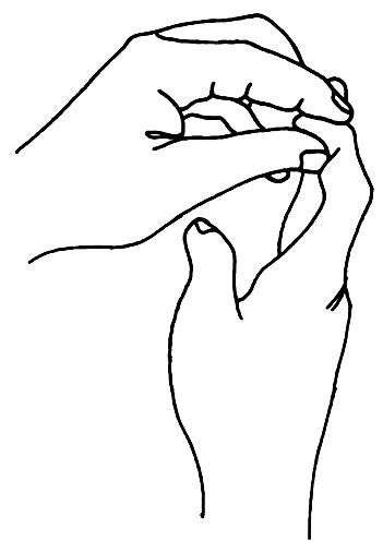 BÖLÜM 2: ÜST EKSTREMİTE BÖLGESİ Mekanizması Genellikle parmak ucunun kıstırılmış ya da sıkıştırılmış yaralanmasıdır. Semptomlar Parmak ucunda ağrı ve şişlik olur.