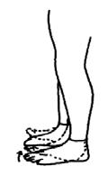 Plantar facia germe: Yaralanmış ayağın ön kısmıyla basamakta durulur ve yavaşça ayak arkında gerilme hissedene kadar topukla basamağın alt kısmına kadar ulaşılır.