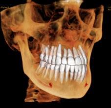 7 Dental Görüntüleme 3 Boyutlu İmajlara Yönelmektedir 3D Görüntüleme Konik