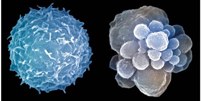 Apoptoz : bitki ve ağaçlardaki mevsimsel yaprak dökümü Apoptoz ile ölen hücrelerde morfolojiik değişiklikler olmaktadır.