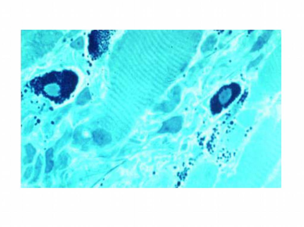 (internet ten alınmıştır) Mast hücresi granülleri heparin, histamine, eozinofilik kemotaktik factor (ECF-A )ve diğer vazoaktif mediyatörlerin kaynağıdır.