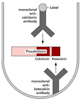 ENFEKSİYON KANITLARI?