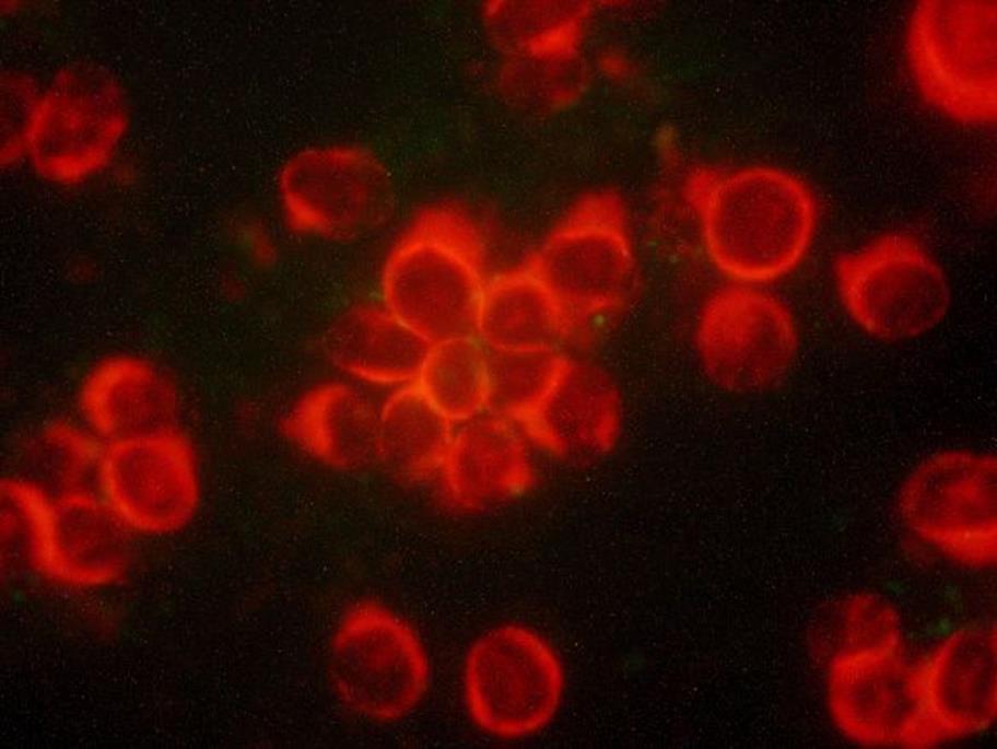 Immunofluorescence assay (IFA): SARS-CoV-infected Vero cells incubated with negative control serum.