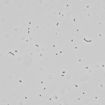 (A) (B) (A) Leu.mesenteroides ssp mesenteroides in mikroskobik görünümü (B) Katı besiyerinde Leu.