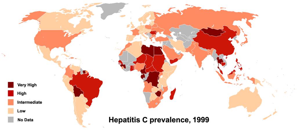 Hepatit C Virüsünün Global Epidemiyolojisi 102 milyon hasta, dünya popülasyonunun %2.8 i infekte Mısır 1950-1980 HCV prevalansı %15-50, 1980 sonrası %1.