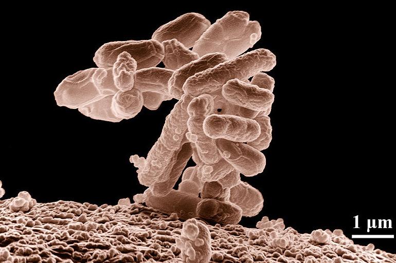 Koliform Bakteri Grubu Şekil: 10,000 kez büyütülmüş bir Escherichia coli bakteri kolonisi Bu organizmalar patojen olmayıp suda mevcut olmaları dışkı ile bir kirlenmeyi ve buna bağlı olarak potansiyel