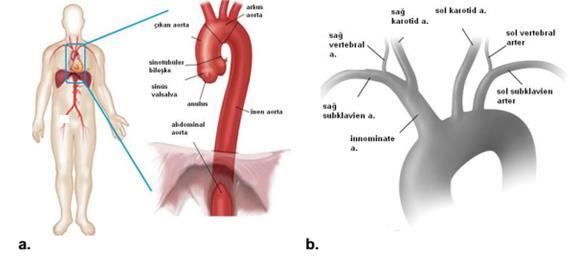 2.2. Torakal Aort Anatomisi Torakal aorta, posterior mediasten yerleşimli olup asendan aorta, arkus aorta ve desenden aorta olmak üzere üç ana bölümden oluşur (Resim 2).