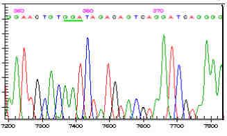 Şekil 12. EPCR 3.Ekzon reverse primeri ile yapılan DNA dizi analizi (homozigot örnek) 3.3.4. EPCR 4. Ekzon 1.