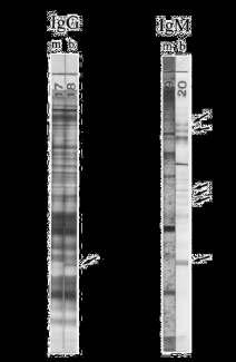 Western blot Konjenital toksoplazmozis tanısını geleneksel serolojik yöntemlere kıyasla 3 ay daha erken koyabilmekte.