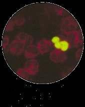 Viral proteinlerin saptanmas (pp65) Antijenemi testinde saptanan matriks proteini Pozitif hücre sayısı/incelenen toplam PMNL sayısı oranı ile yorumlanır Hücre kültüründen