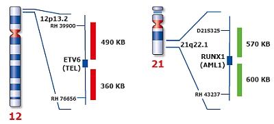 t(12;21) ETV6 RUNX1 En sık gözlenen genetik bozukluk ETV6 Trankripsiyonel baskılayıcı 2 domain HLH protein dimerizasyon