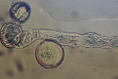 İncelemeye alınan üzüm çeşitlerinin polen çimlenme mikrografileri; Semillon (m), Trakya İlkeren (n),