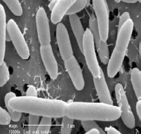 13 2.3.1. Lactobacillus cinsi bakterilerin genel özellikleri Lactobacillus cinsi bakteriler, Lactobacillaceae familyasına ait ve laktik asit bakterileri grubundadırlar.