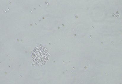 Kültürün 5. gününden sonra hibrid hücrelerin HAT besiyerinde küçük koloniler şeklinde bölünerek gelişmeye başladıkları gözlendi (şekil 3.9). Şekil 3.