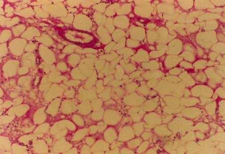33 2. Kahverengi yağ hücreleri: Kahverengi yağ dokusu vücutta ısı kaybına engel (izolatör) olarak görev yapar. Rengini lipokrom pigmentinden alır. Sitokromlarca zengin mitokondrileri vardır.