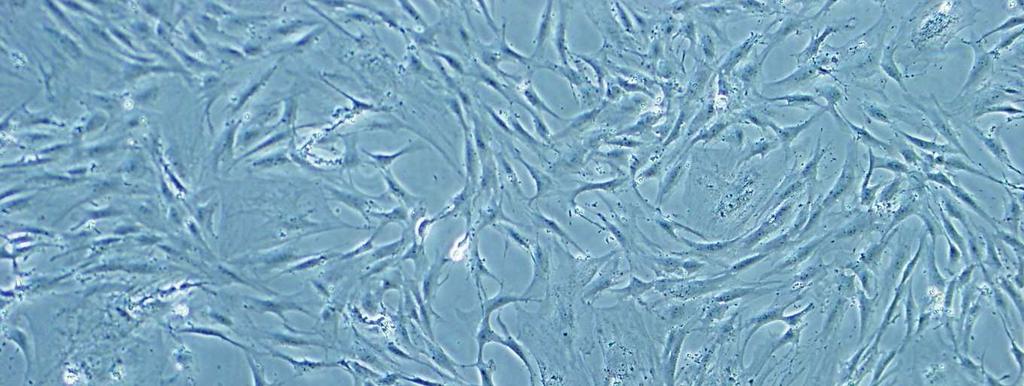fibroblast benzeri, sitoplazmalarının bipolar uzanan
