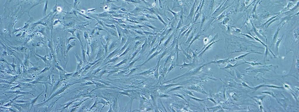Morfolojik inceleme sonucunda tutunan hücrelerin literatürde