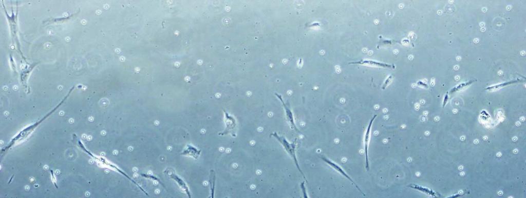 24 saat sonra izole edilmiş hücrelerin kültür flaskı tabanına adezyonları mikroskobik olarak tespit edildi. Bu donörden fazla sayıda hücre izolasyonu sağlandı.