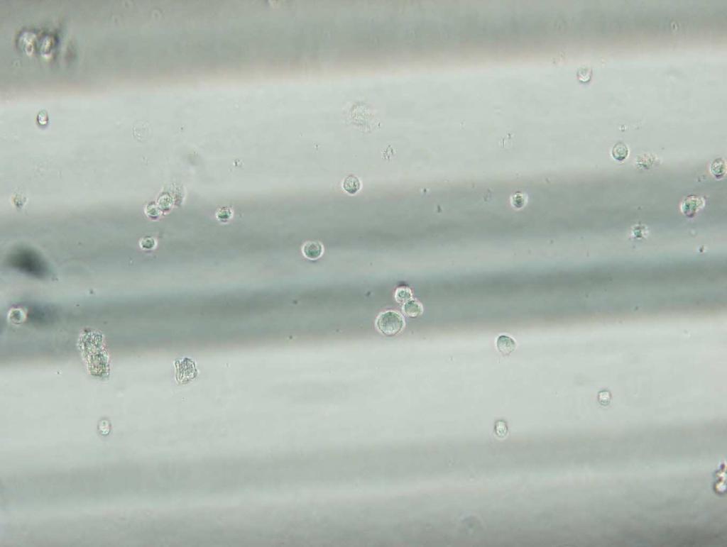 78 Şekil 4.23: AD-MKH lerin mikrokapiler içindeki mikroskobik görünümü (1.